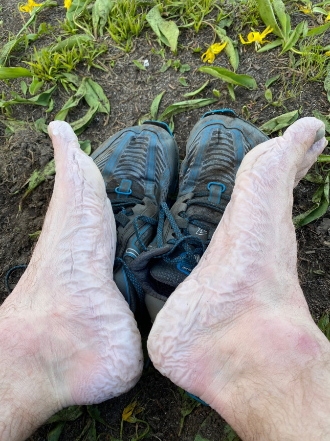 waterlogged-feet waterlogged-feet